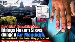 Guru SMAN 1 Rengel (SMANSAR) Diduga Hukum Siswa dengan Air Mendidih, Korban Alami Luka Bakar Hingga Operasi, Perlindungan Anak Dipertanyakan